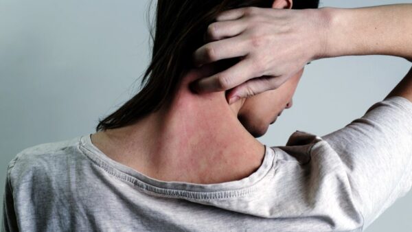 Foundations: Shingles - Holistic Solutions