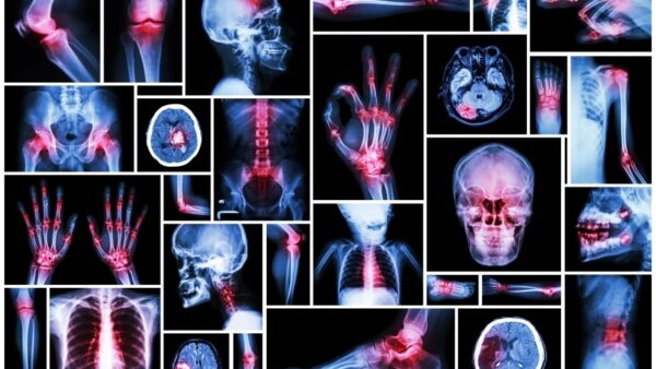 Foundations: Living the Anti-Inflammatory Life - 2 Part Series