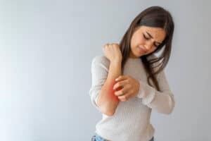 Natural Remedies for Psoriasis